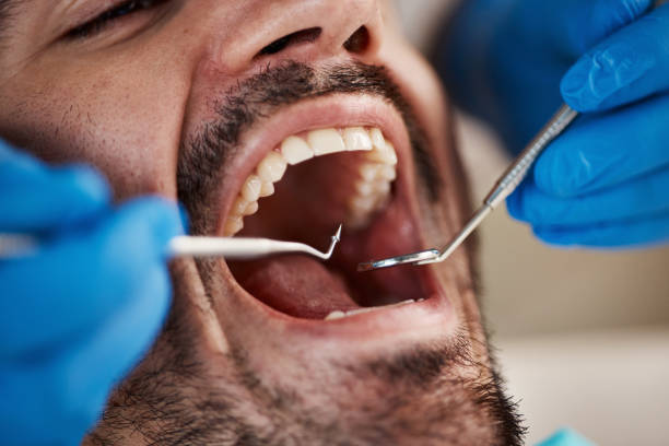Best Emergency Denture Repair in Erie, IL